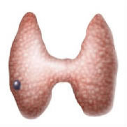 nodulo tiroide